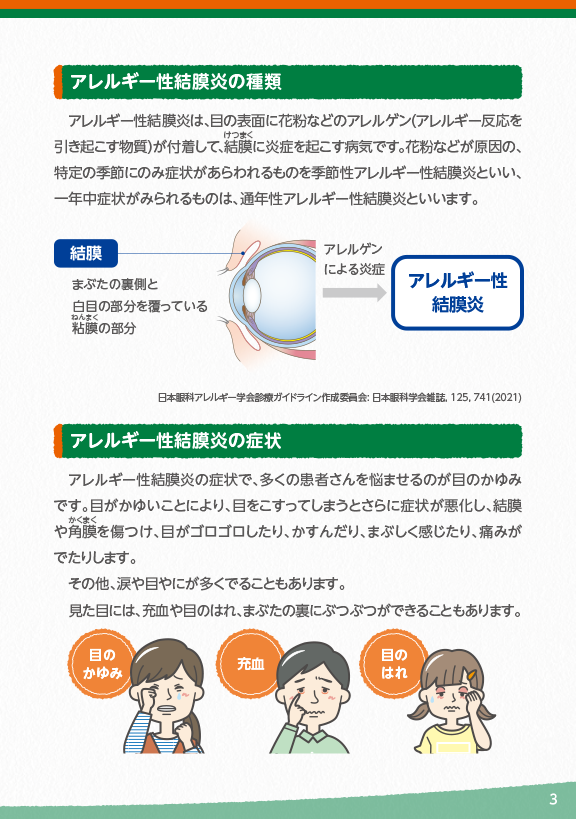 アレルギー性結膜炎の種類と症状