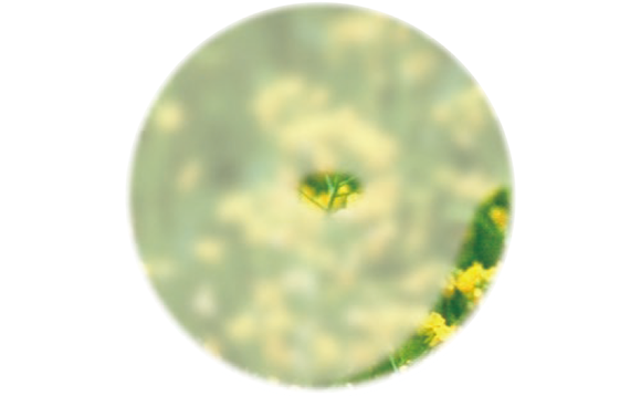 筒から外の風景を覗いているように見えます。歩くと人やものにぶつかったりすることが多くなります。ただし、もう片眼の視野がよい場合、この状態でも気づかないことがあります。