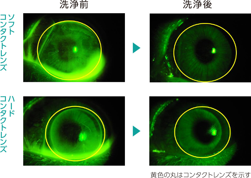 ソフトコンタクトレンズ、ハードコンタクトレンズの洗浄前後の眼表面像。黄色の丸はコンタクトレンズを示す
