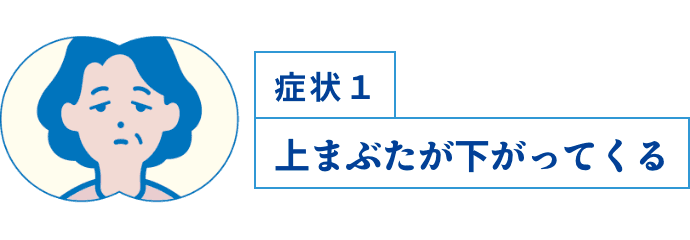 症状1 上まぶたが下がってくる