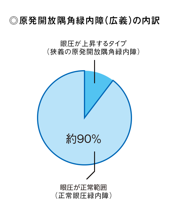 原発開放隅角緑内障(広義)の内訳