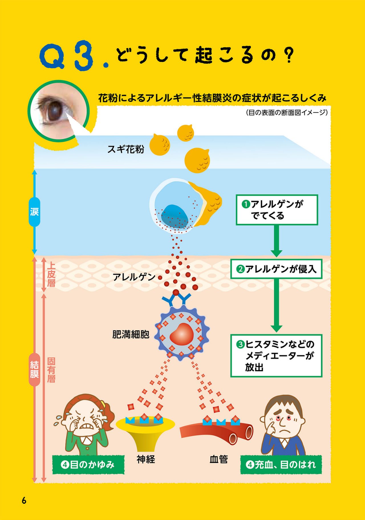 どうして起こるの？