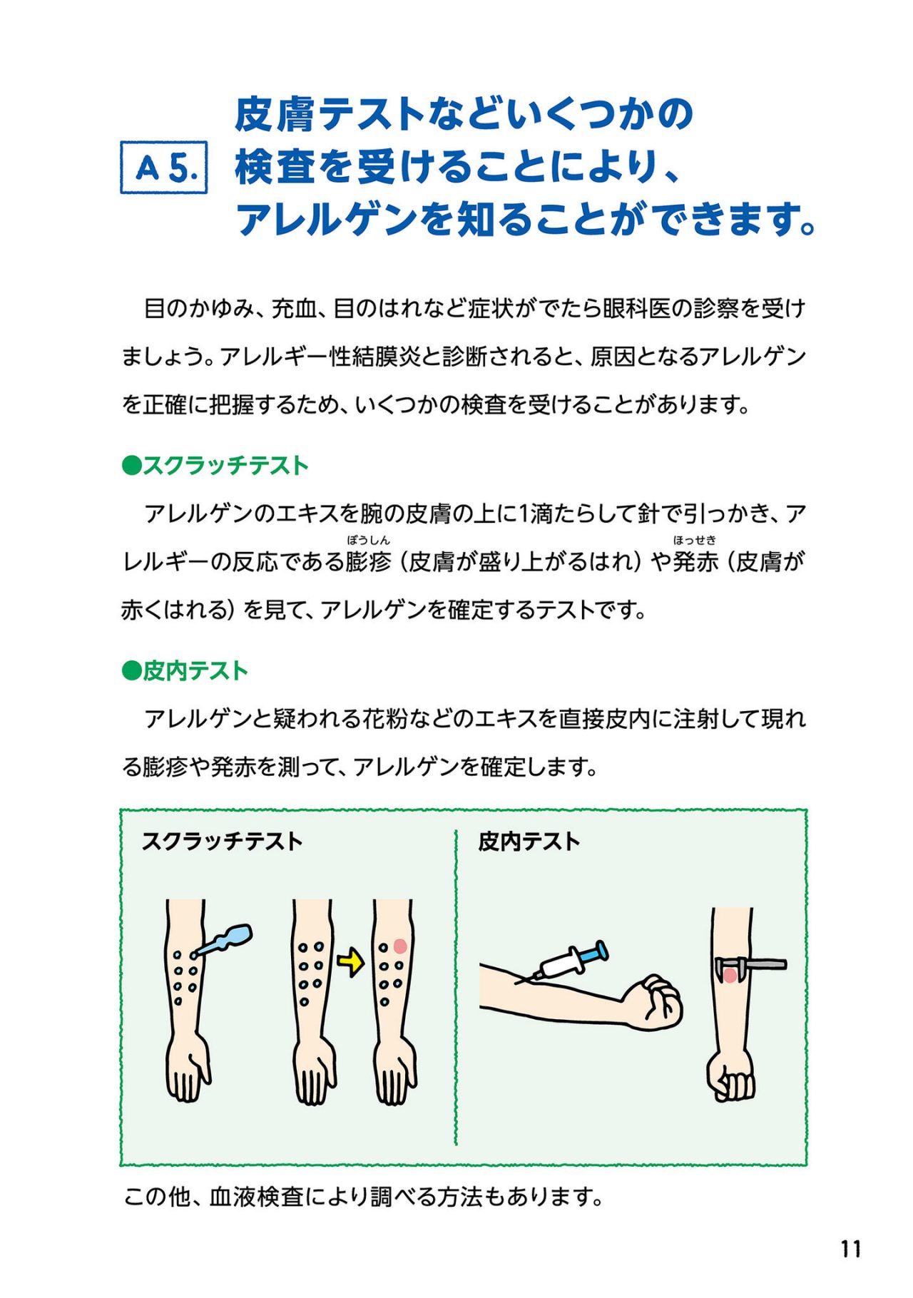 皮膚テストなどいくつかの検査を受けることにより、アレルゲンを知ることができます。