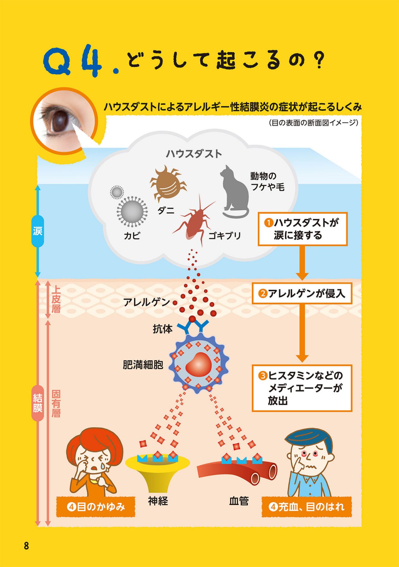 どうして起こるの？