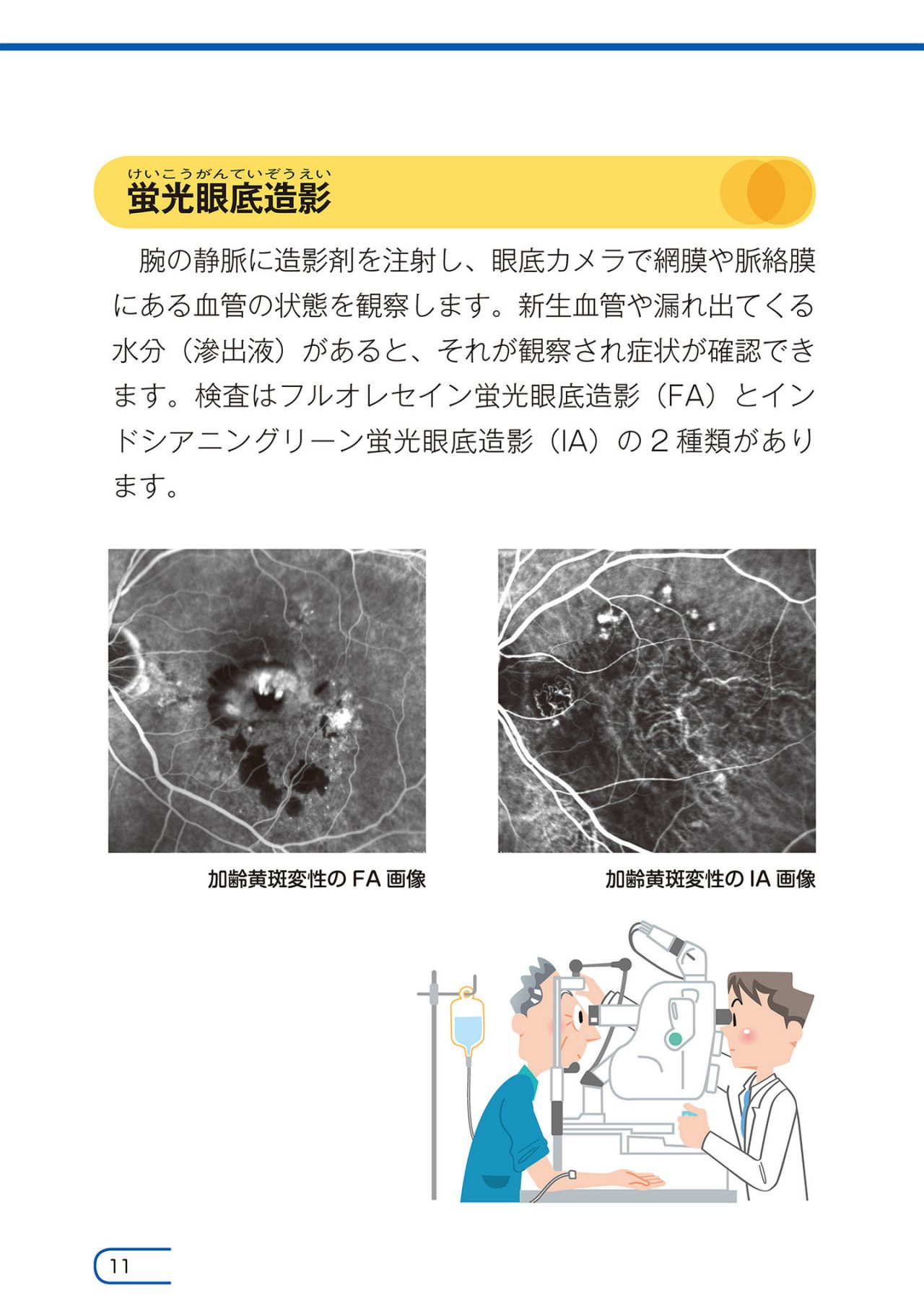 小冊子：知っていますか？加齢黄斑変性 | 参天製薬日本サイト