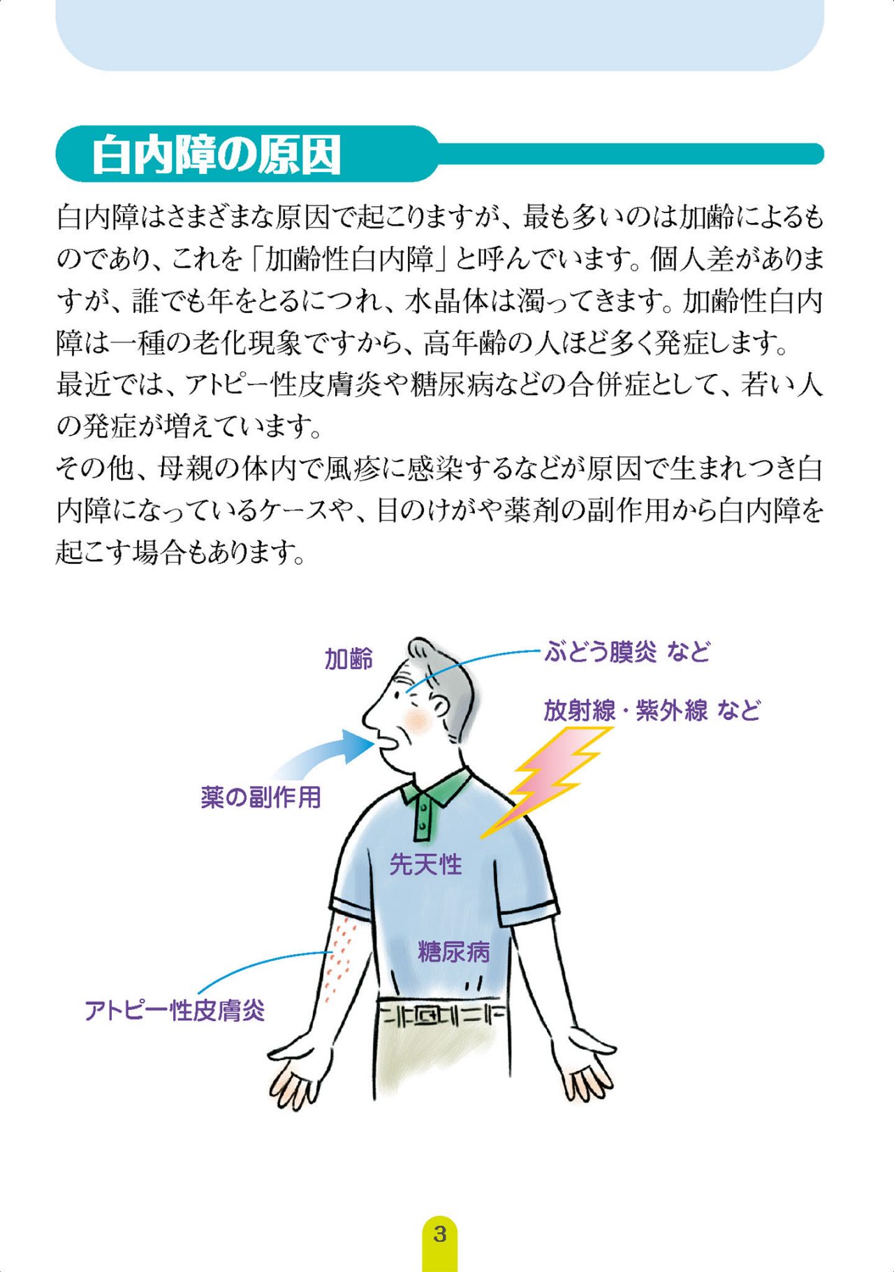 白内障の原因