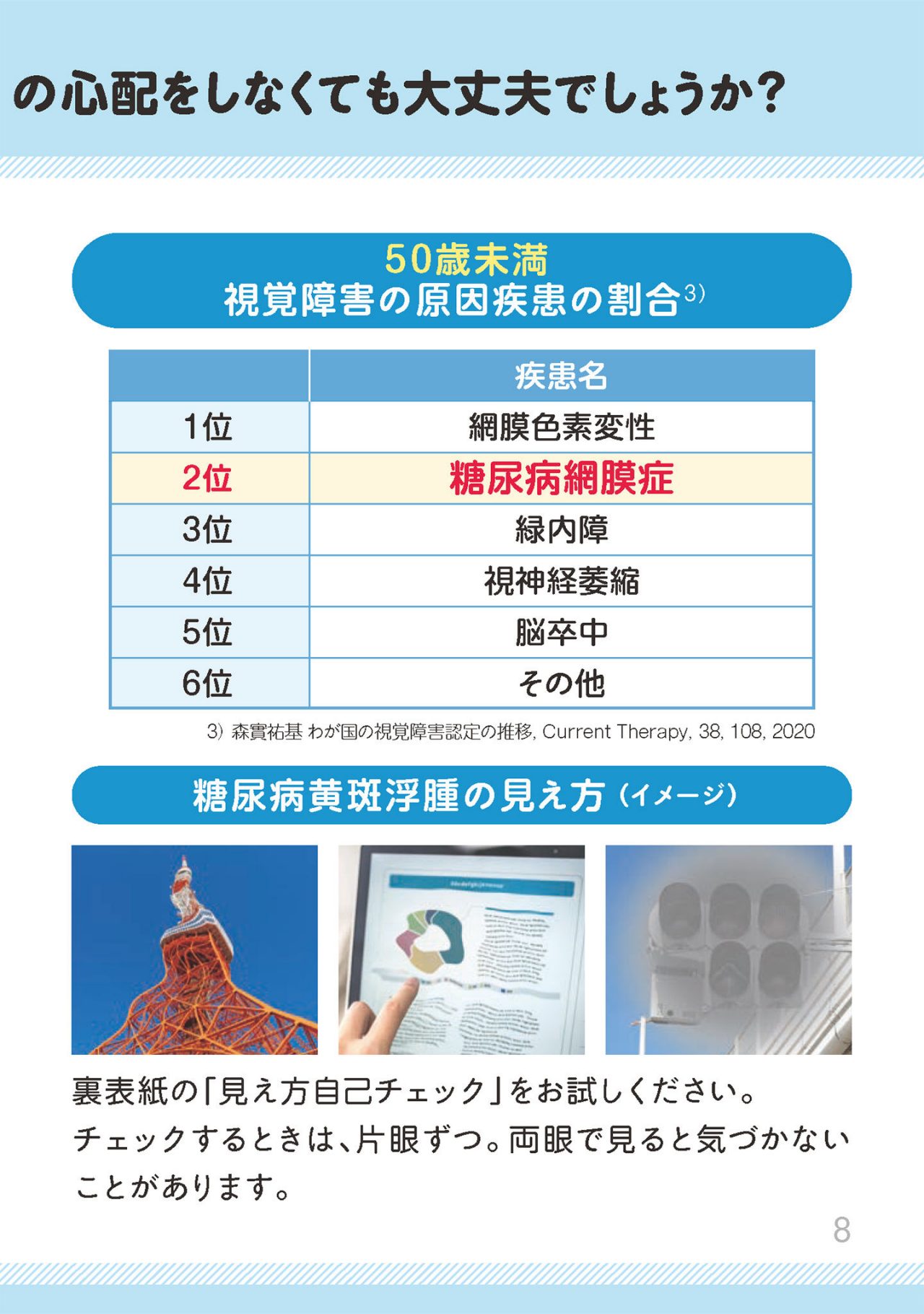 若いうちは、糖尿病による眼の合併症の心配をしなくても大丈夫でしょうか？