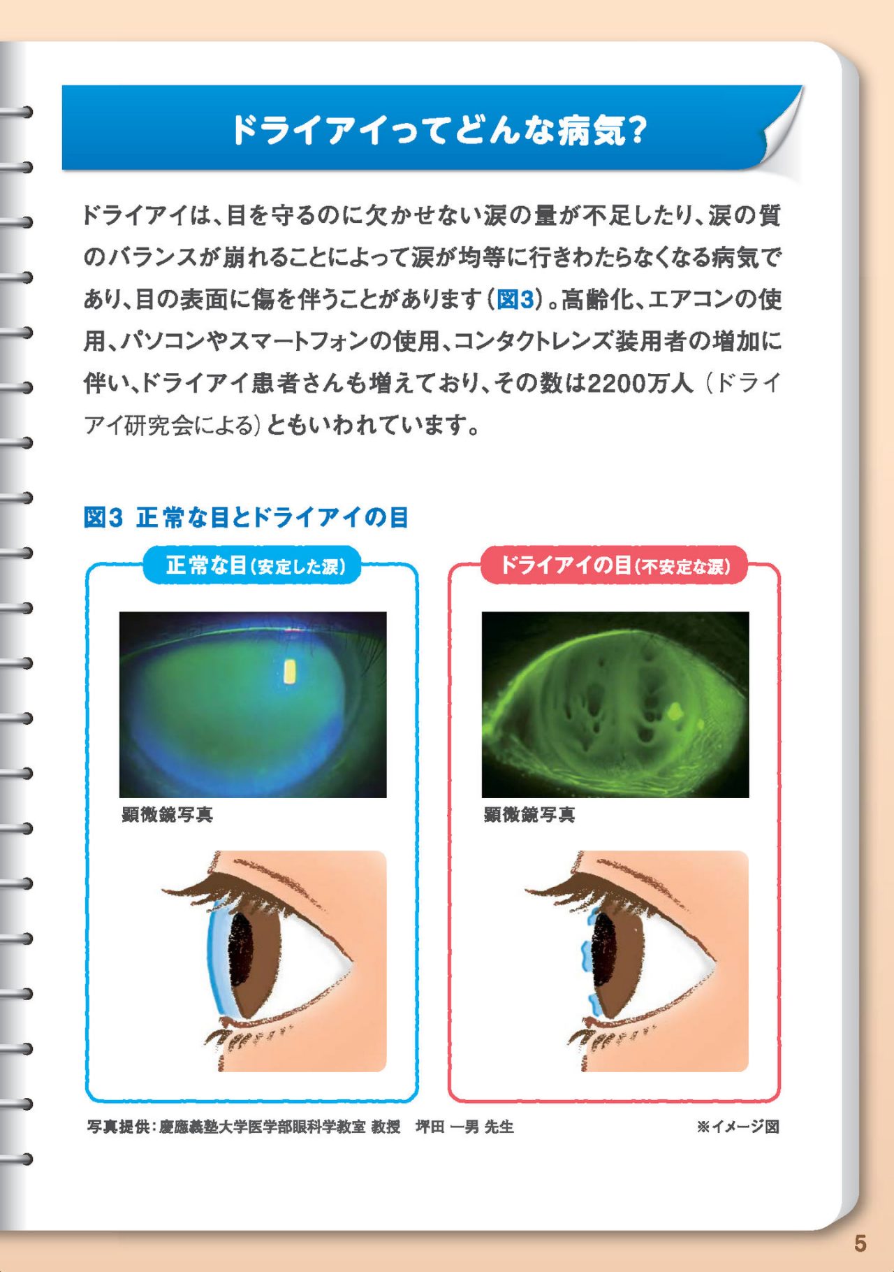 涙は目を守るための大切なもの