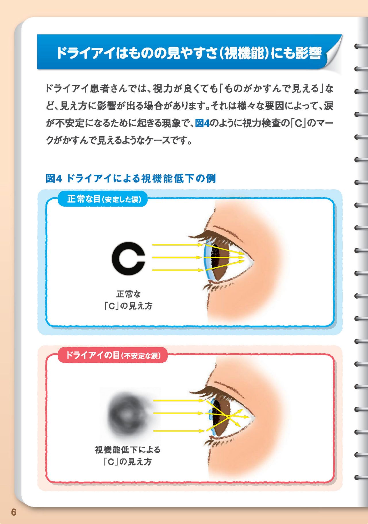 ドライアイはものの見やすさ（視機能）にも影響