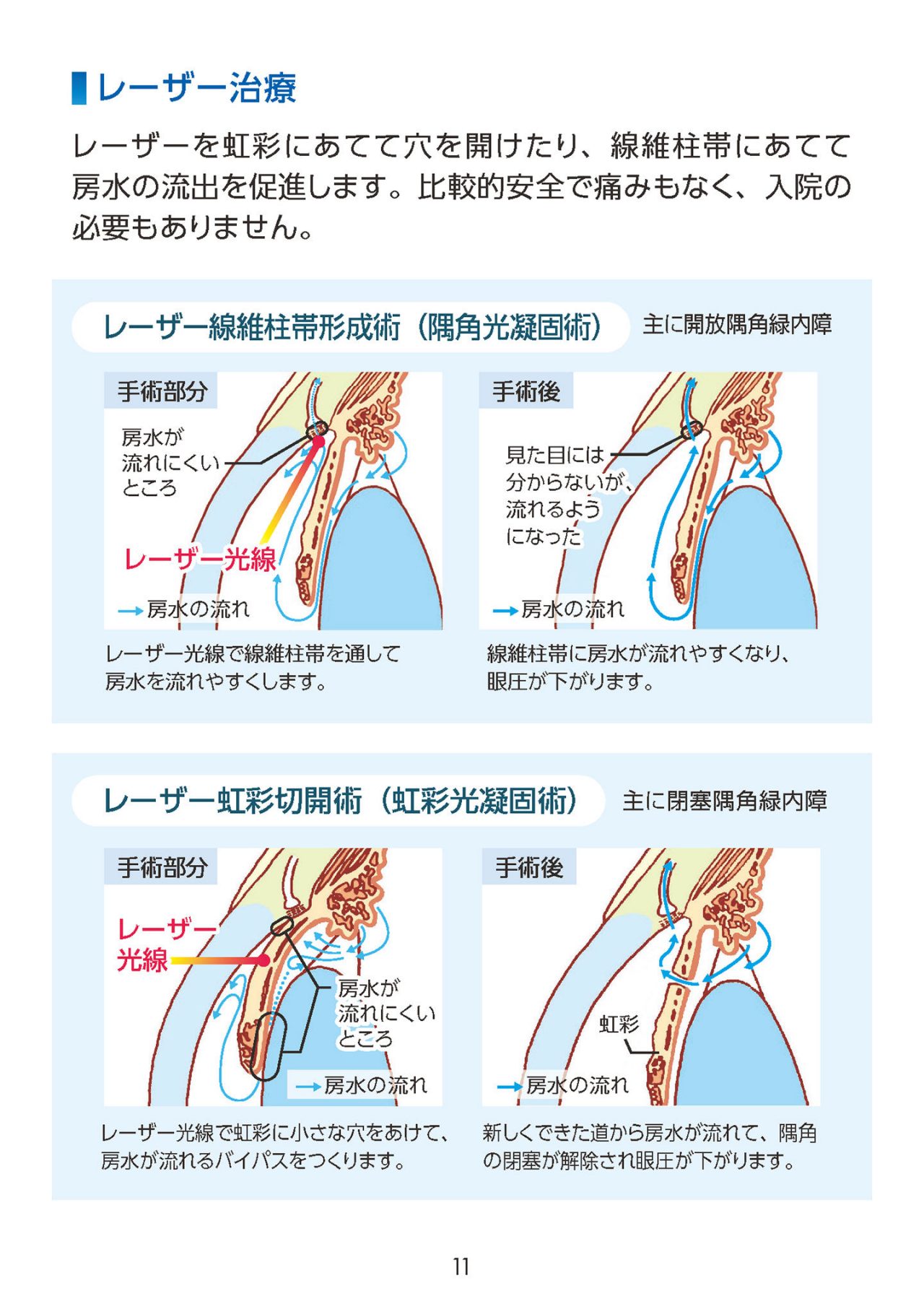 大切な目を守るために