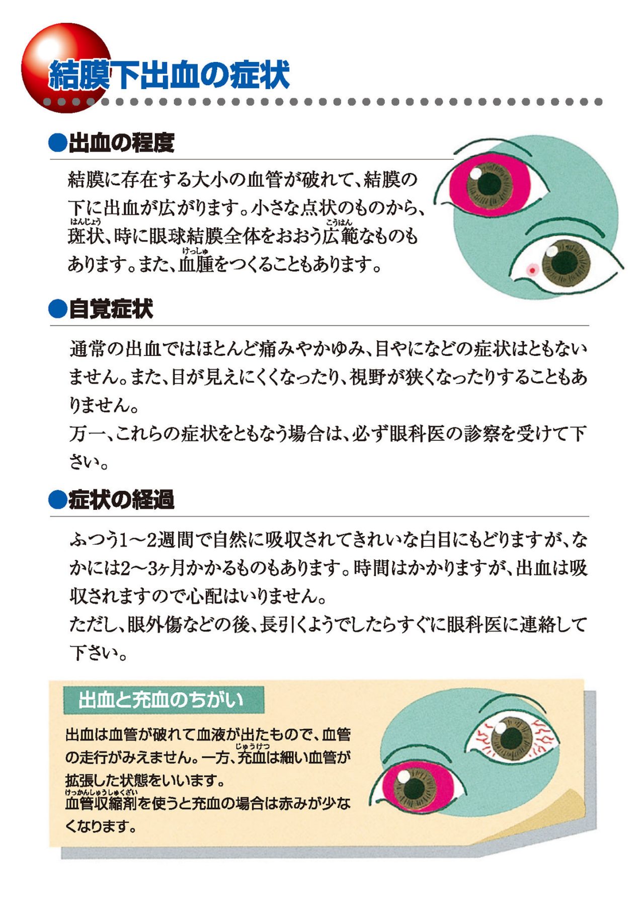結膜下出血の症状
