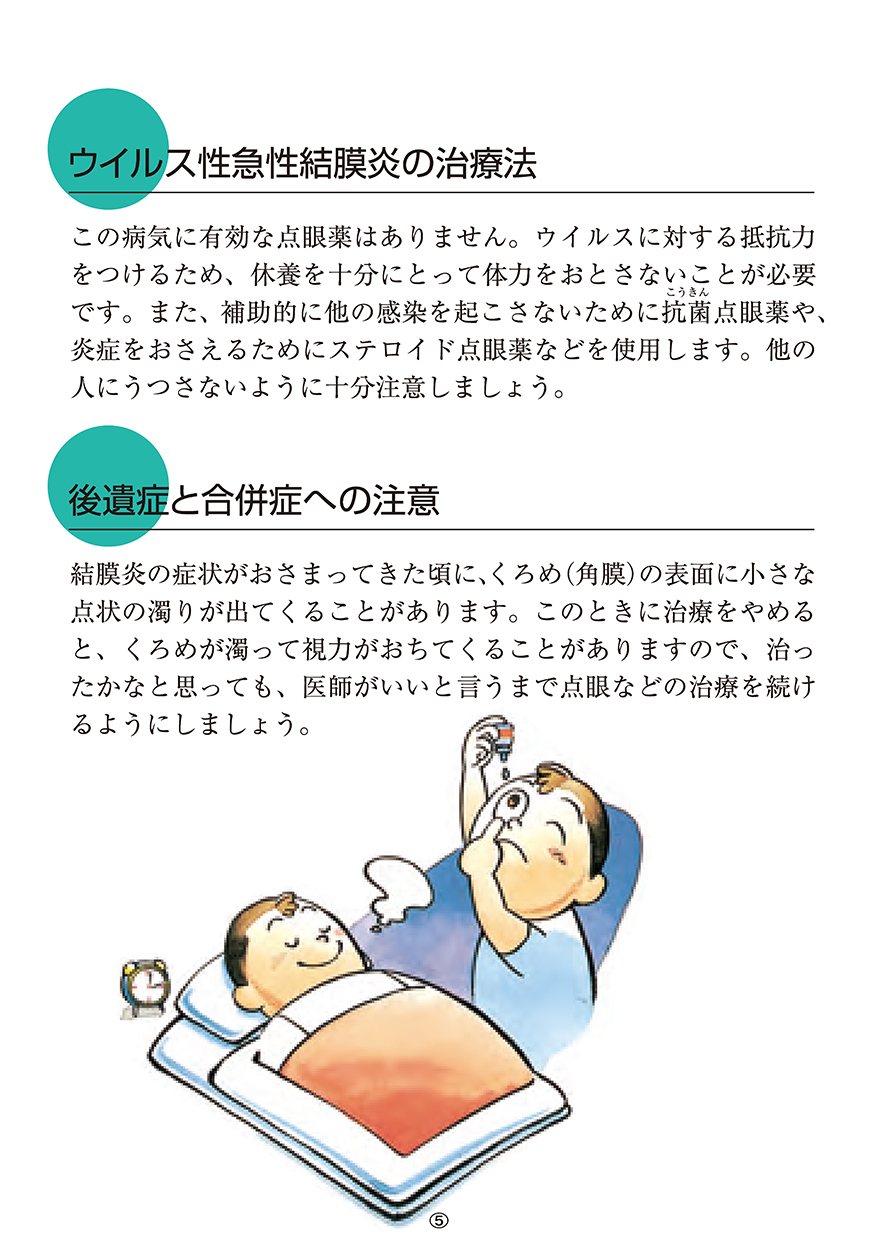 ウイルス性急性結膜炎の治療法