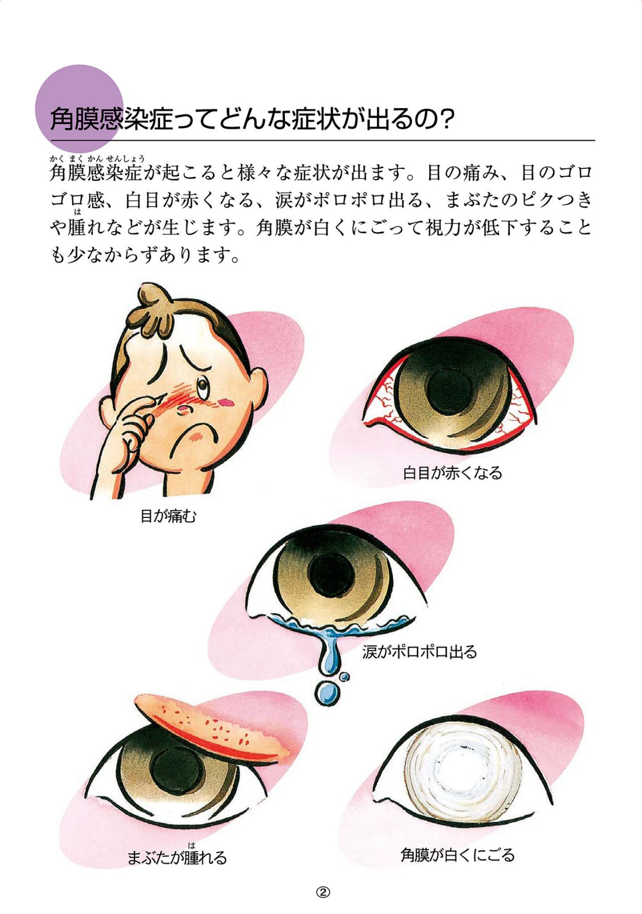 角膜感染症ってどんな症状が出るの？
