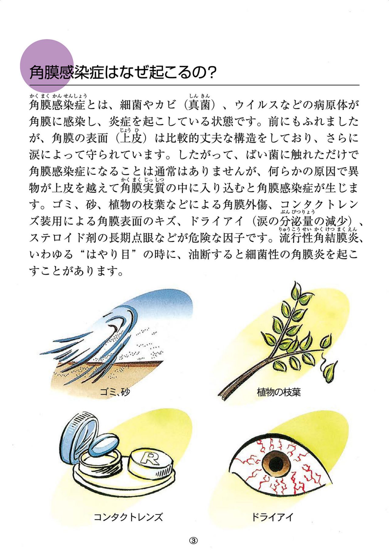 角膜感染症はなぜ起こるの？