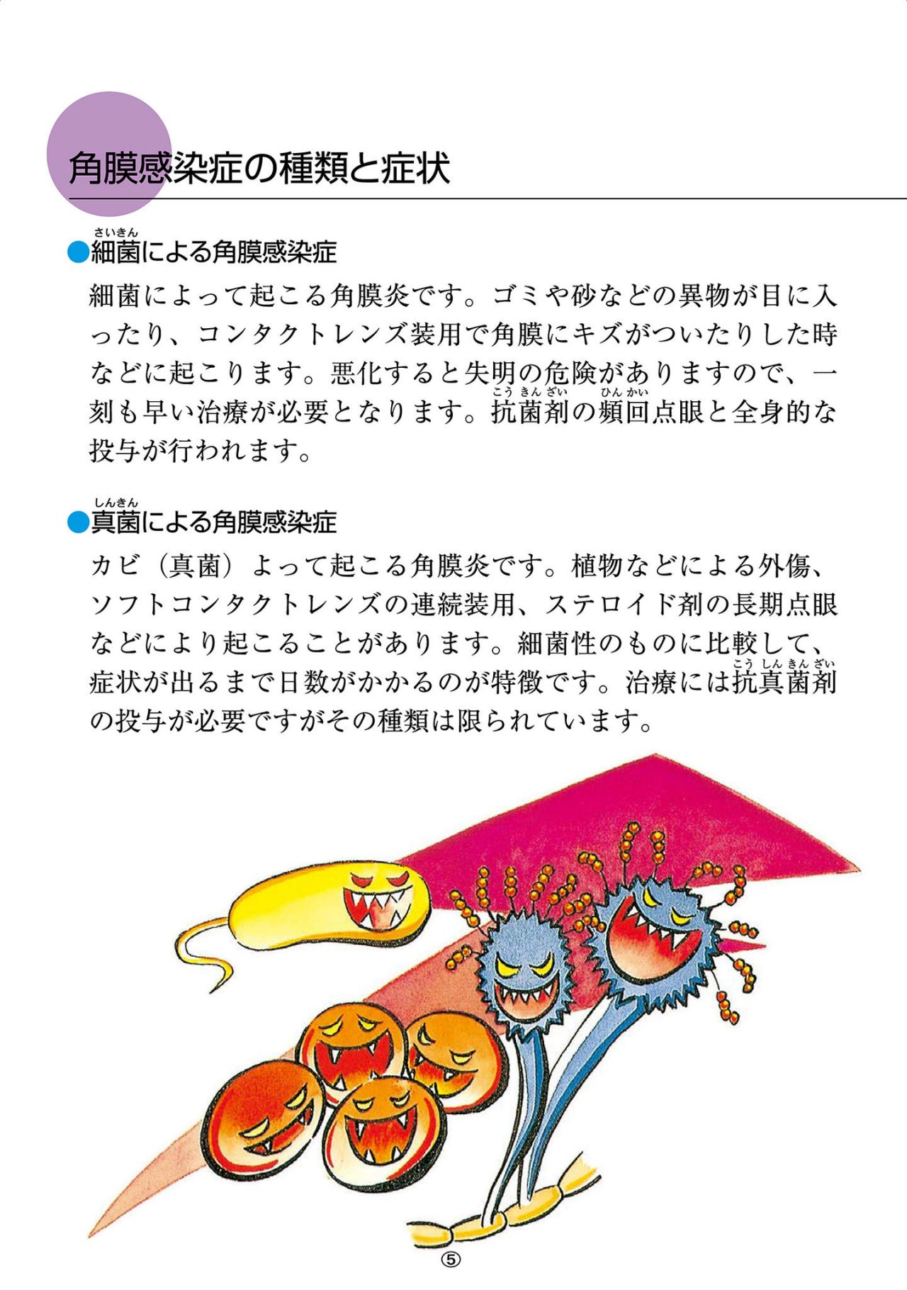 角膜感染症の種類と症状