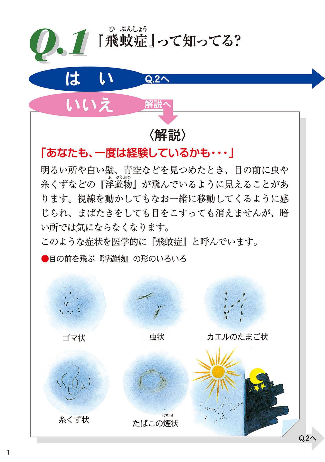 「飛蚊症」って知ってる？