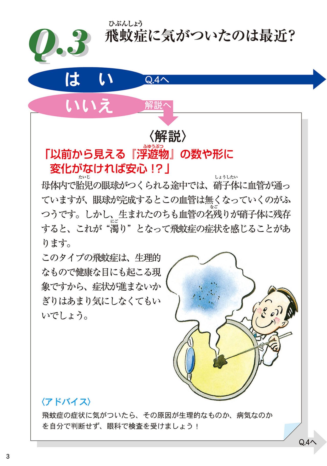 飛蚊症に気がついたのは最近？