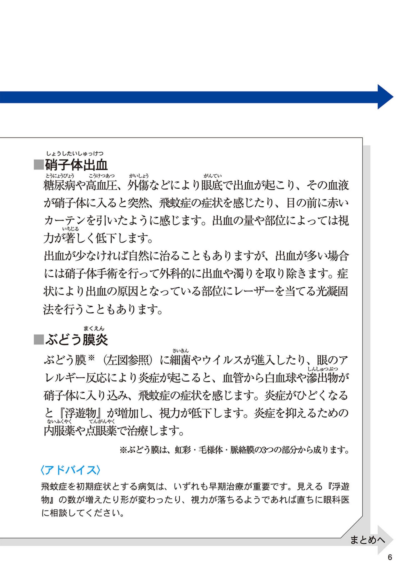 飛蚊症の症状の変化に注意してる？